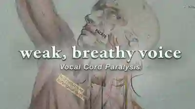 Vocal Cord Paralysis YouTube thumbnail