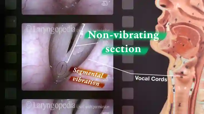Segmental Vibration YouTube Thumbnail
