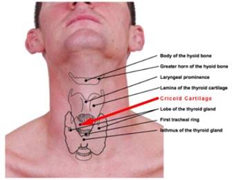 Overlay of Cricoid Cartilage on male neck