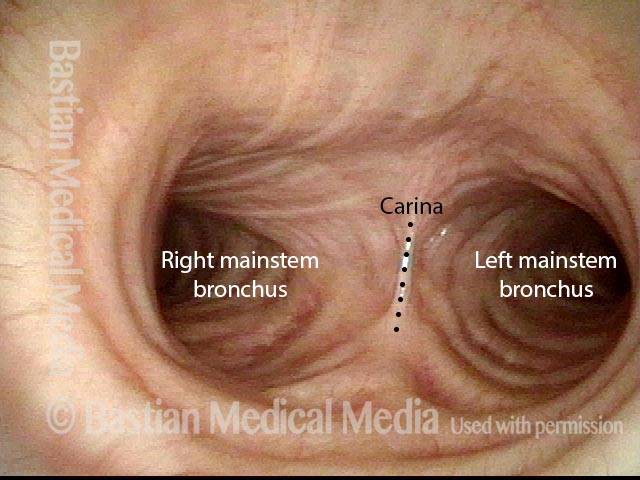 lower trachea