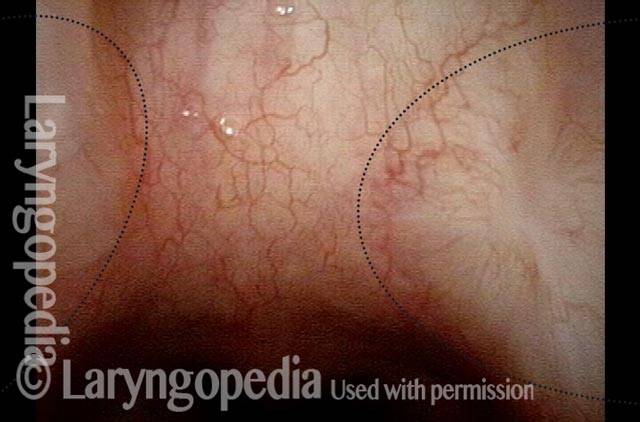small superficial-looking scar