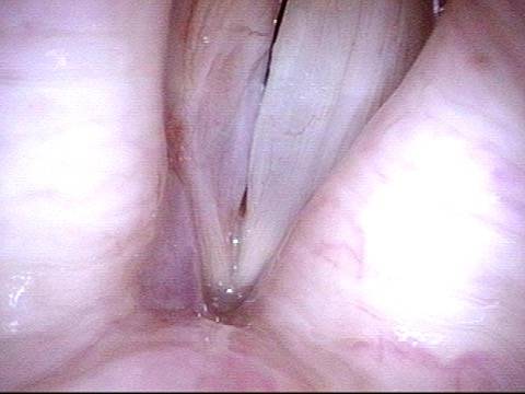 Mucosal Injury