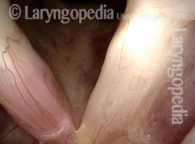 anterior upper surface is coated with mucus