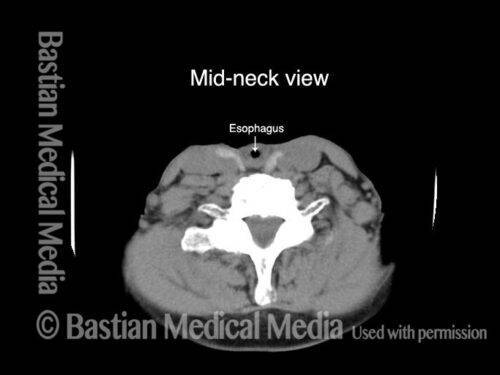 Esophagus - Laryngopedia