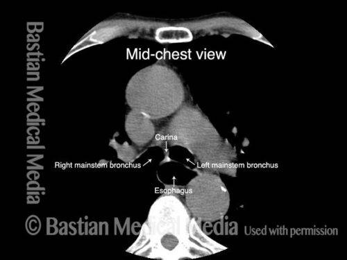 Esophagus - Laryngopedia