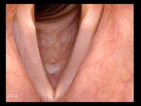vocal cords