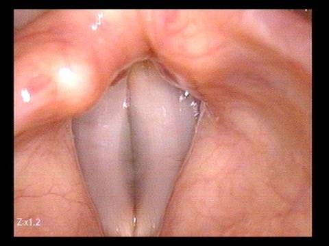Vocal cords during voice