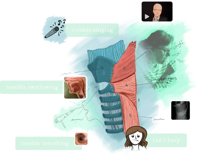 Illustration of cricopharyngeus muscle on a model with images of the larynx, x-rays of the abdomen, and other multimedia content relating to laryngology.