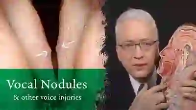 Vocal nodules & other voice injuries YT Thumbnail