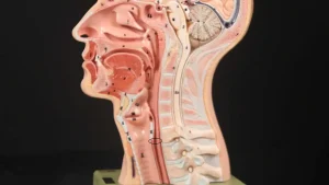 Retrograde Cricopharyngeus Dysfunction (R-CPD)