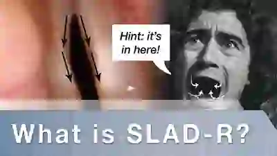 what is SLAD-R YT Thumbnail