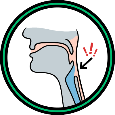 Illustration of painful swallowing