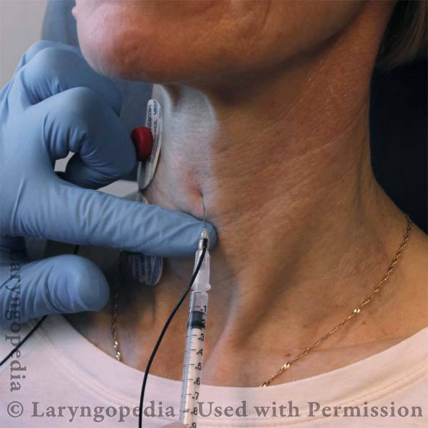 Instruction Manual for Spasmodic Dysphonia Injections + photos