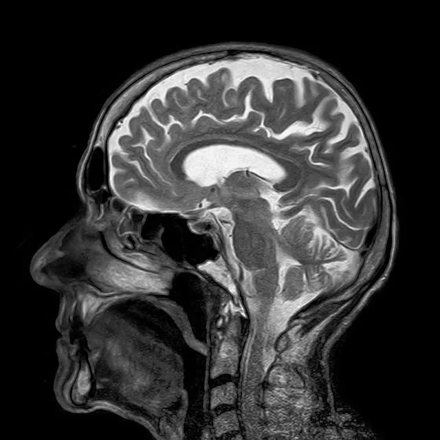 Image of an MRI